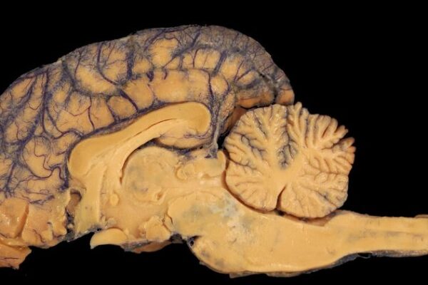Training the brain