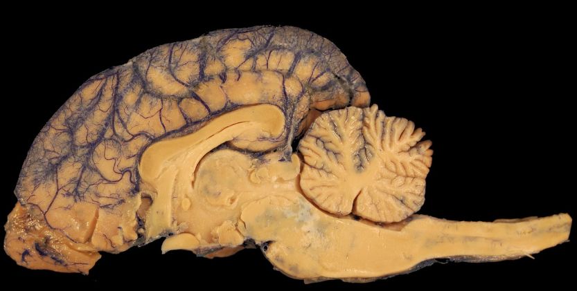 Training the brain